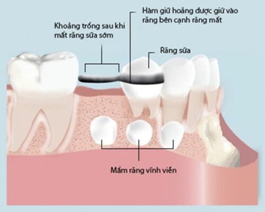 Hàm giữ khoảng