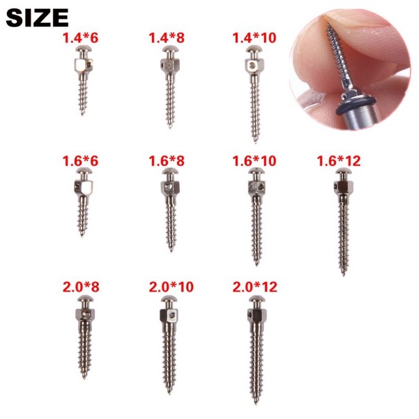 Tác dụng của minivis và cách sử dụng minivis trong chỉnh nha